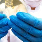 The Importance Of Bacteria Removal